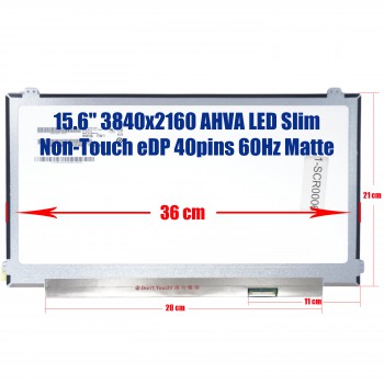Laptop Screen 4K 15.6" 3840x2160 LED LCD  40 pin Brackets Top Brackets Bottom Right Connector (SCU.1-SCR0006 )